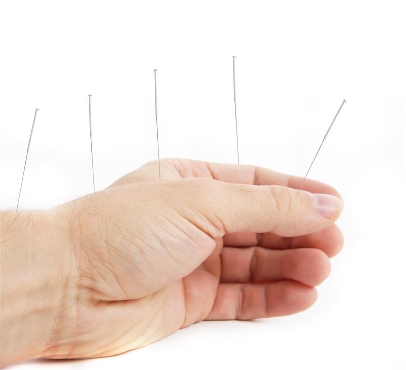 AdobeStock_10712938 – Grande Aiguille d'acupuncture insérée dans la main.