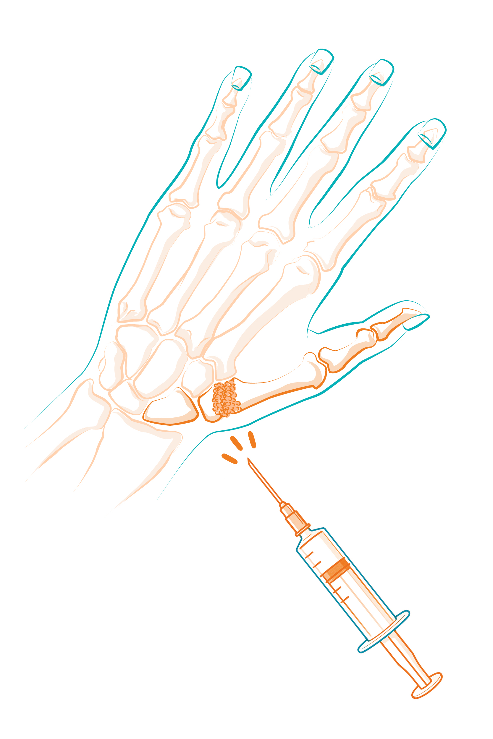 kerimedical_seringue_main Illustration d'une main avec injection médicale.