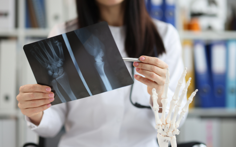 Médecin examine des radiographies du bras.