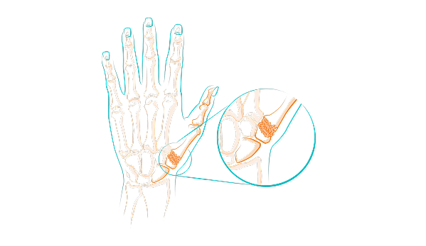 Illustration d'un squelette de main.
